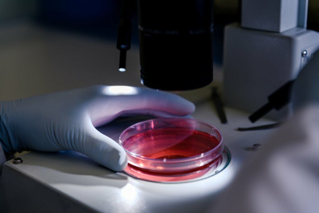 Leucemia linfoma y mieloma que son en que se diferencian y cuales son sus sintomas y tratamientos MOSAICO 1